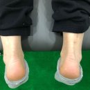 트레스비짐 이미지