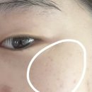 리젠토닝 색소케어 후기! [미모다뷰티 괴정점]