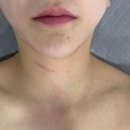 경상남도 사과이용연구소 | 진주 하대동 강선뷰티동안연구소 후기✨ 수영 후 어깨목 뭉침 풀린 찐힐링!