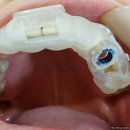 굿모닝 치과기공소 이미지