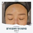 조이드림 | 양산피부관리, 올가드림뷰티 양산 범어점 모공디톡스 후기