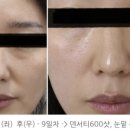 미뉴얼의원 이미지