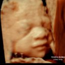 성남시분당구보건소 | 분당제일여성병원 28주 3차 정밀초음파, 입체초음파 백일해접종 후기｜아기 얼굴 제대로 보고 온 날