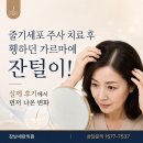 Hair by the J.M | 휑하던 가르마에 잔털이, 강남세란 탈모 세포치료