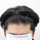 더헤어라인성형외과의원 이미지