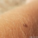 서울나온피부과의원 네이버블로그