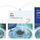 삼성스마일안과의원 네이버블로그