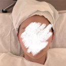 청담하트피부과의원 | 청담피부과 엠레드의원 티타늄 튠라이너 후기｜장원영 피부과