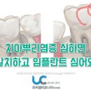 길음튼튼약국 | 이빨뿌리염증으로 어금니 발치후기 임플란트 필요했다?