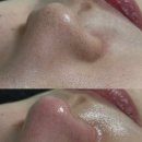 엔젤스킨뷰티샵 | [마산뷰티샵] 마산 세라링 합성동 스킨플래닝 후기 | 모리에스테틱