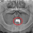 아치치과기공소 이미지