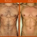 아일왁싱 이미지