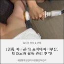 [수원 영통 바디관리] 포이에마피부샵 테라노바 팔뚝 관리 후기 (웨딩 관리 추천)