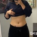 인바디광주 | 광주비만클리닉, 복부제로팻주사 4주차 후기 !