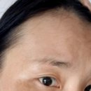 장희빈
