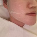빠른케어 성동사업소 | 회사 근처에서 찾은 성수피부관리 성동구피부관리 트리버에스테틱성수 피버리스 열감다운 트러블관리