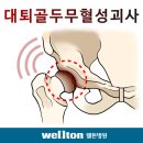 고관절 관리방법//인공고관절 수술후 관리방법 이미지