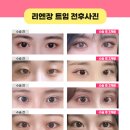 세미성형외과의원 이미지