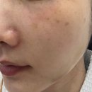 메디센스 이미지