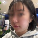 성재영이즈피부과의원 | 부산 성재영피부과에서 올타이트 리프팅 솔직 후기