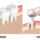 재성치과 네이버블로그