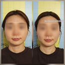 바디메뉴얼 | 엘트리움 스킨앤바디 일산화정점 6G 무중력윤곽관리 후기