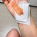 ㅠㅠ | 러닝하다 넘어졌어요ㅠㅠ | 손바닥 찰과상 치료 후기, 어느 병원을 가야 할까?