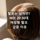 현미프로헤어 | 탈모는 남자만? NO! 20·30대 여성형 탈모 급증 이유