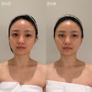 F5 | W34.울산 신부관리 F5에프오에스테틱 후기