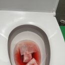 풀블러드 | 아인병원 제왕절개 후기(페인버스터, 척추마취부작용, 블러드패치, 가스통, 소변줄)