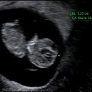 판교가온산부인과의원 이미지