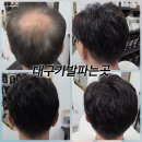 김호증모클릭헤어샵 | 대구가발 파는곳 300여가지 다양한 제품과 증모가발명장의 실력으로