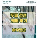 아우르다 | 영등포 두피건선 관리 후기 아우르다