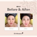 연산동피부관리 클린스킨 후기 | 부산신부관리 준비하는 예비신부 윤곽관리 코스