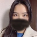 제스타성형외과의원 | 쌍꺼풀수술 너무 어려웠던 병원선택 중윤석호원장님에게 앤드에서 자연유착+앞트임 수술 받고 왔습니다^^