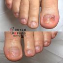레푸스 네이버블로그