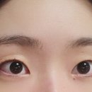 바르떼뷰티광주