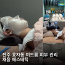 효자동피부관리 채움에스테틱 압출 세멘시트 후기