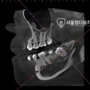 미성동-38 네이버블로그