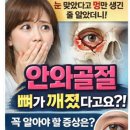 대신성모안과의원 | 송탄 안과 송탄성모안과, 눈을 맞거나 부딪힌 후 안와골절 조심해야해요.