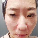 이수역 5번 출구 앞 | 리쥬란HB 이수역피부과