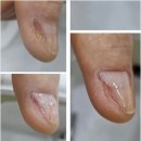 파나슈 뷰티 | 편안함과 전문성이 공존하는 인천문제성발톱관리, 파나슈뷰티 후기