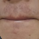 리츠피부과의원 이미지