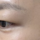 아이다속눈썹