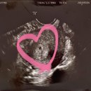 정성일산부인과의원 이미지