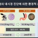 장상피화생 원인 증상 진단 좋은 음식 이미지