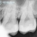 e-플란트치과 이미지
