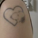 멍반장 | 문신 지우는 영수쌤 / 선 굵은 타투 제거 1~7회차 후기 (+제거 Tip)