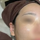 나은필병원 | 첫방문 이벤트만 조지는 30대 여성의 잠실 피부과 피부관리 기록 (LDM/아쿠아필/라라필/블랙필)