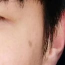 양산빛나라피부과의원 | (필독) 양산빛나라피부과의원 리뷰 및 공익제보